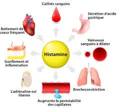 Histamine et migraine